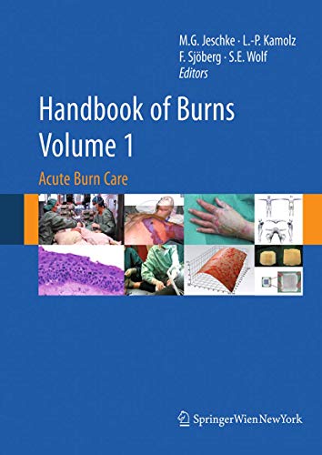 Handbook of Burns Volume 1 Acute Burn Care [Paperback]