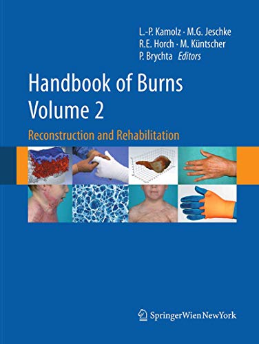 Handbook of Burns Volume 2 Reconstruction and Rehabilitation [Paperback]