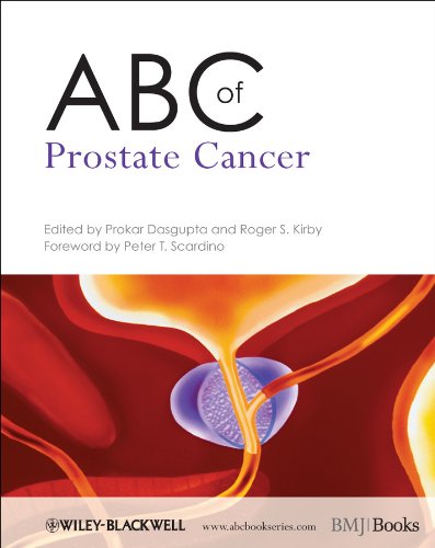 ABC of Prostate Cancer [Paperback]
