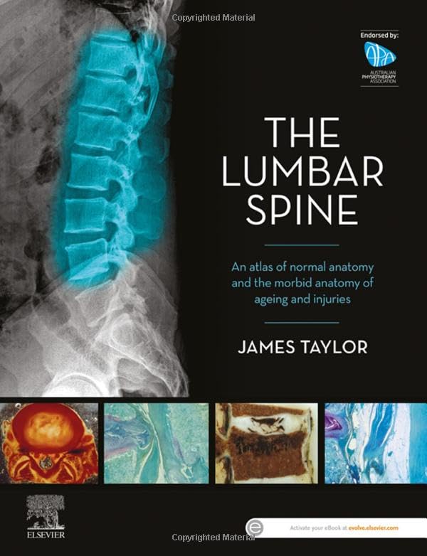 The Lumbar Spine An Atlas of Normal Anatomy and the Morbid Anatomy of Ageing an [Paperback]