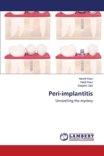 Peri-Implantitis [Paperback]