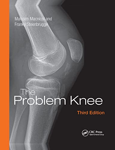 The Problem Knee [Paperback]