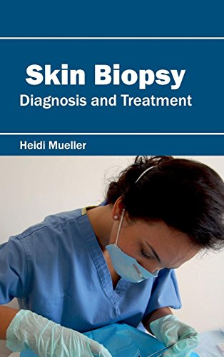 Skin Biopsy Diagnosis And Treatment [Hardcover]