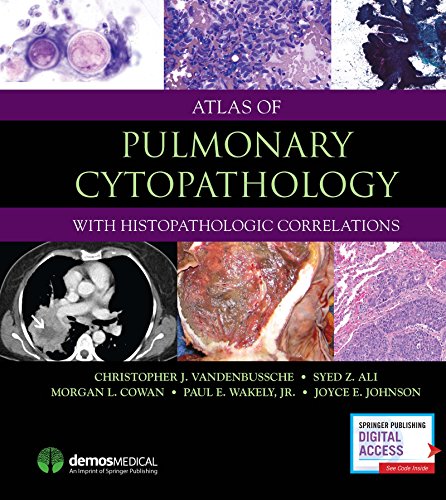 Atlas of Pulmonary Cytopathology [Hardcover]