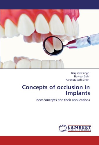 Concepts Of Occlusion In Implants New Concepts And Their Applications [Paperback]