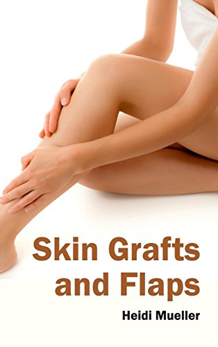 Skin Grafts And Flaps [Hardcover]