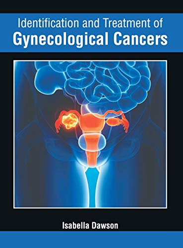 Identification and Treatment of Gynecological Cancers [Hardcover]