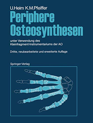 Periphere Osteosynthesen unter Verwendung des Kleinfragment-Instrumentariums de [Paperback]