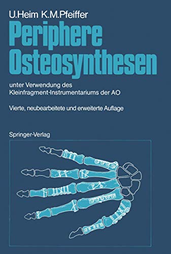 Periphere Osteosynthesen unter Verwendung des Kleinfragment-Instrumentariums de [Paperback]