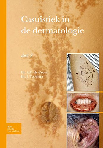Casu}}stiek in de dermatologie - deel 2 [Paperback]