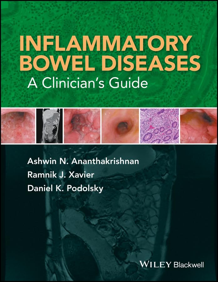 Inflammatory Bowel Diseases A Clinician's Guide [Hardcover]