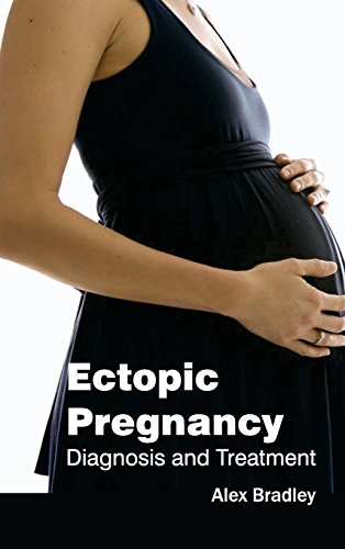 Ectopic Pregnancy Diagnosis And Treatment [Hardcover]