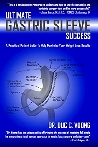 Ultimate Gastric Sleeve Success A Practical Patient Guide To Help Maximize Your [Paperback]