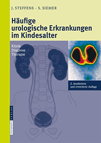 Hufige urologische Erkrankungen im Kindesalter Klinik Diagnose Therapie [Hardcover]