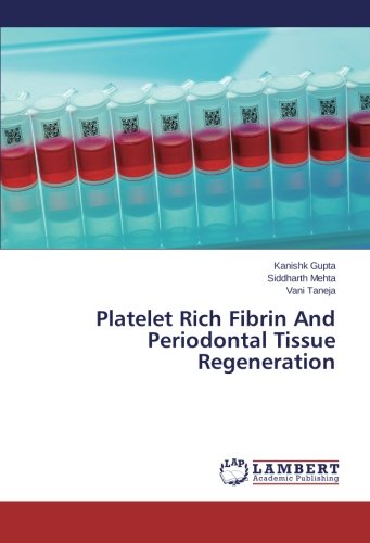 Platelet Rich Fibrin And Periodontal Tissue Regeneration [Paperback]
