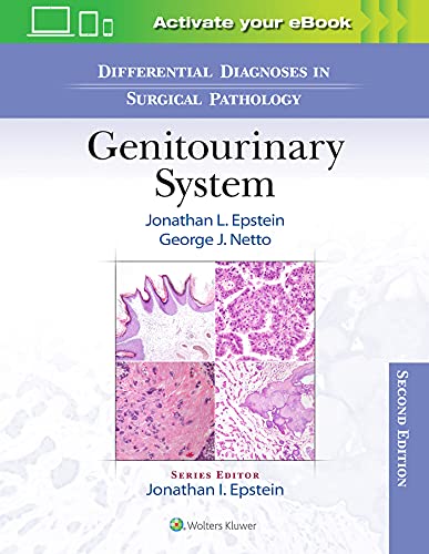 Differential Diagnoses in Surgical Pathology Genitourinary System [Hardcover]