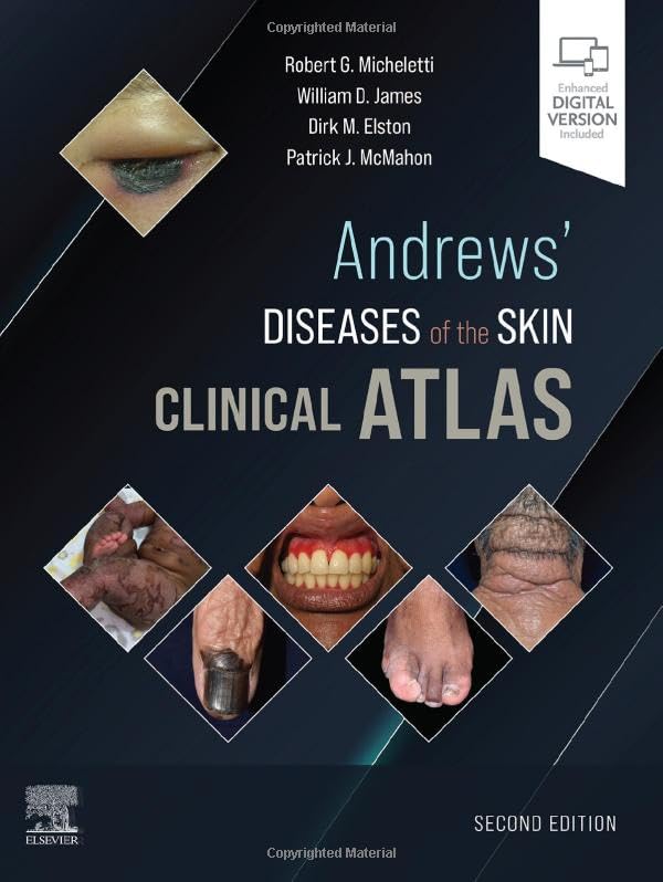 Andrews' Diseases of the Skin Clinical Atlas [Hardcover]