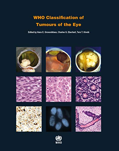WHO Classification of Tumours of the Eye [Paperback]
