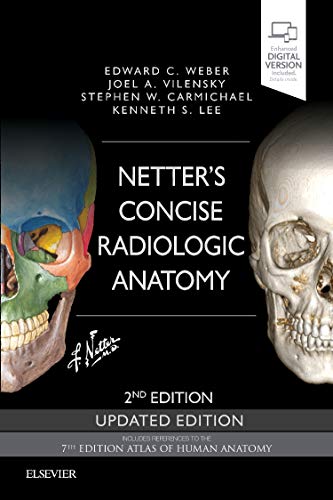 Netter's Concise Radiologic Anatomy Updated Edition [Paperback]