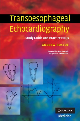 Transoesophageal Echocardiography Study Guide and Practice MCQs [Paperback]