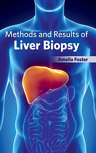 Methods And Results Of Liver Biopsy [Hardcover]