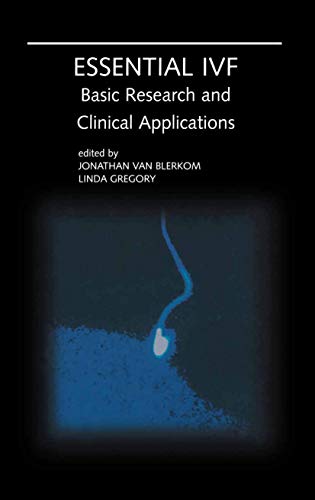 Essential IVF Basic Research and Clinical Applications [Paperback]