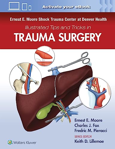 Ernest E. Moore Shock Trauma Center at Denver Health Illustrated Tips and Tricks [Paperback]