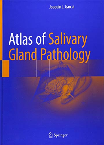 Atlas of Salivary Gland Pathology [Hardcover]