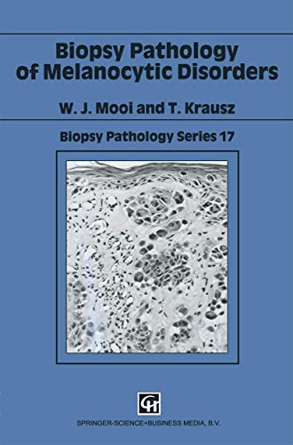 Biopsy Pathology of Melanocytic Disorders [Hardcover]