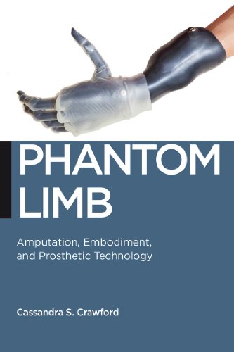 Phantom Limb Amputation, Embodiment, and Prosthetic Technology [Hardcover]