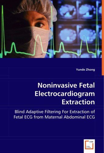 Noninvasive Fetal Electrocardiogram Extraction [Paperback]
