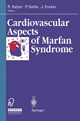 Cardiovascular Aspects of Marfan Syndrome [Paperback]