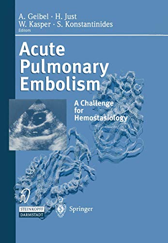 Acute Pulmonary Embolism A Challenge for Hemostasiology [Paperback]
