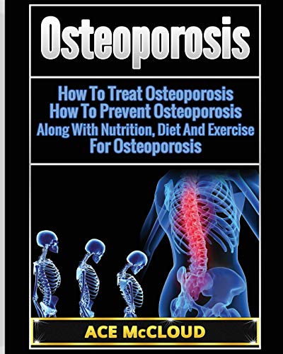 Osteoporosis How To Treat Osteoporosis How To Prevent Osteoporosis Along With [Paperback]