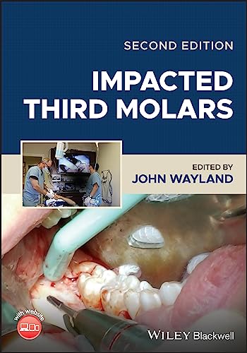 Impacted Third Molars [Hardcover]