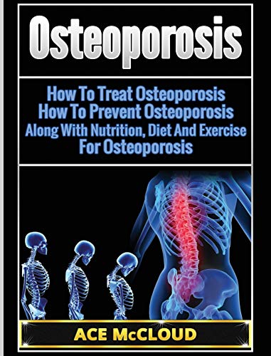 Osteoporosis How To Treat Osteoporosis How To Prevent Osteoporosis Along With [Hardcover]
