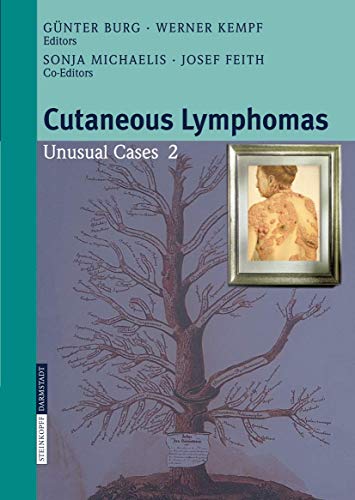 Cutaneous Lymphomas Unusual Cases 2 [Paperback]