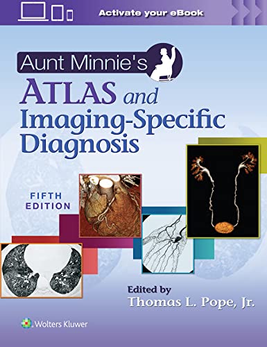 Aunt Minnie&39s Atlas and Imaging-Specific Diagnosis [Paperback]