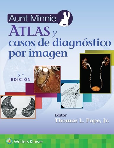Aunt Minnie. Atlas y casos de diagn&243stico por imagen [Paperback]
