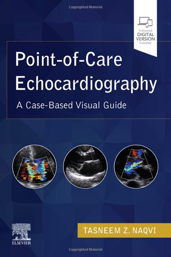 Point-of-Care Echocardiography A Clinical Case-Based Visual Guide [Paperback]