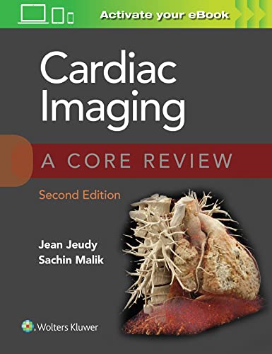 Cardiac Imaging A Core Review [Paperback]
