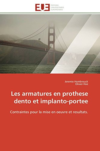 Les Armatures En Prothese Dento Et Implanto-Portee Contraintes Pour La Mise En  [Paperback]
