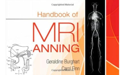 Handbook of MRI Scanning [Paperback]