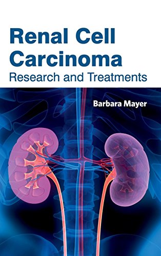 Renal Cell Carcinoma Research And Treatments [Hardcover]