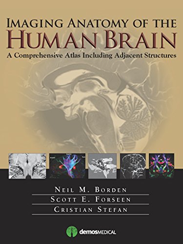 Imaging Anatomy of the Human Brain [Hardcover]