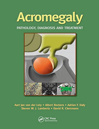 Acromegaly Pathology, Diagnosis and Treatment [Paperback]