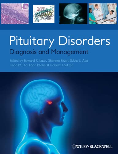 Pituitary Disorders Diagnosis and Management [Paperback]