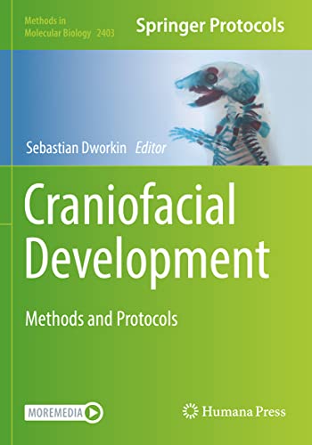 Craniofacial Development Methods and Protocols [Paperback]