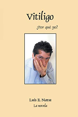 Vitiligo (spanish Edition) [Paperback]