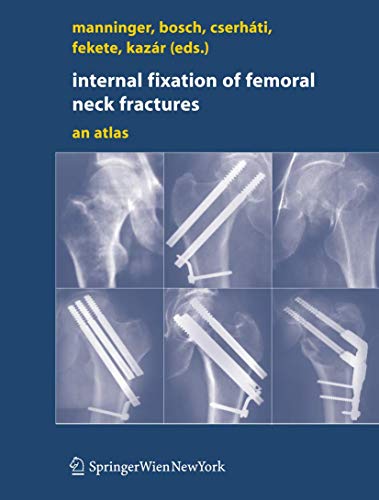 Internal fixation of femoral neck fractures An Atlas [Hardcover]
